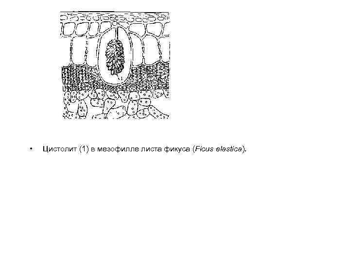 • Цистолит (1) в мезофилле листа фикуса (Ficus elastica). 