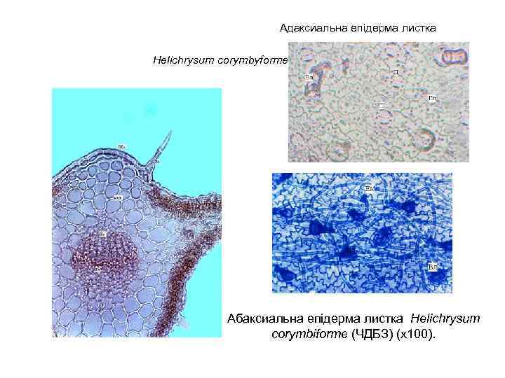  Адаксиальна епідерма листка Helichrysum corymbyforme (х 400). Абаксиальна епідерма листка Helichrysum corymbiforme (ЧДБЗ)