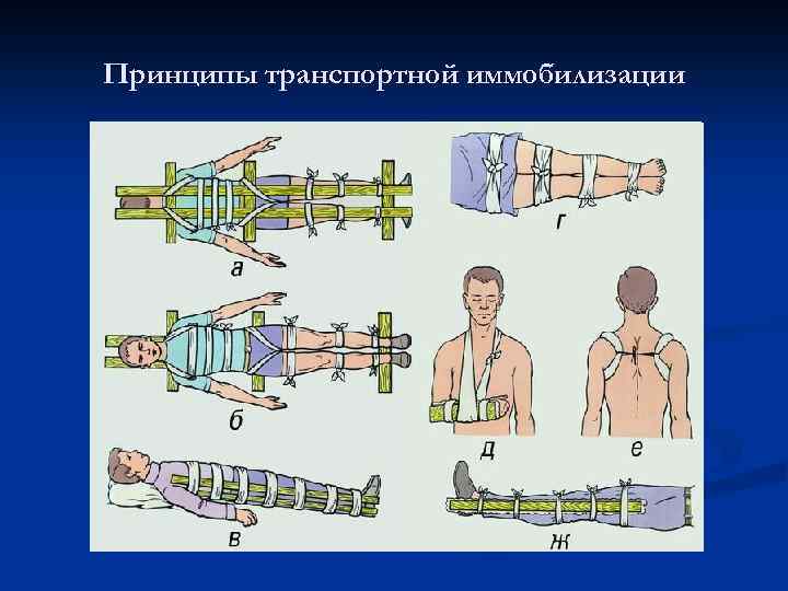 Транспортная иммобилизация картинки