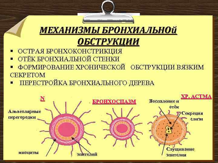 МЕХАНИЗМЫ БРОНХИАЛЬНОй ОБСТРУКЦИИ § ОСТРАЯ БРОНХОКОНСТРИКЦИЯ § ОТЁК БРОНХИАЛЬНОЙ СТЕНКИ § ФОРМИРОВАНИЕ ХРОНИЧЕСКОЙ ОБСТРУКЦИИ