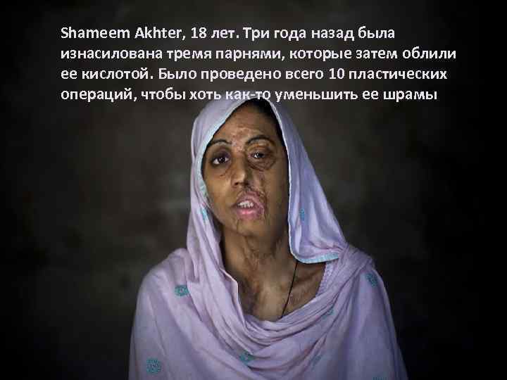 Shameem Akhter, 18 лет. Три года назад была изнасилована тремя парнями, которые затем облили