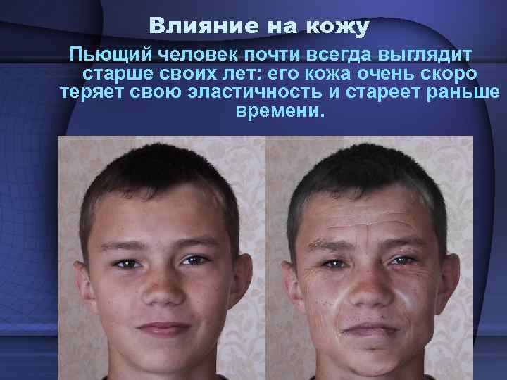Влияние на кожу Пьющий человек почти всегда выглядит старше своих лет: его кожа очень