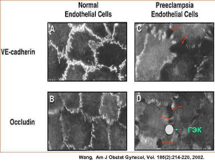 ГЭК Wang, Am J Obstet Gynecol, Vol. 186(2): 214 -220, 2002. 