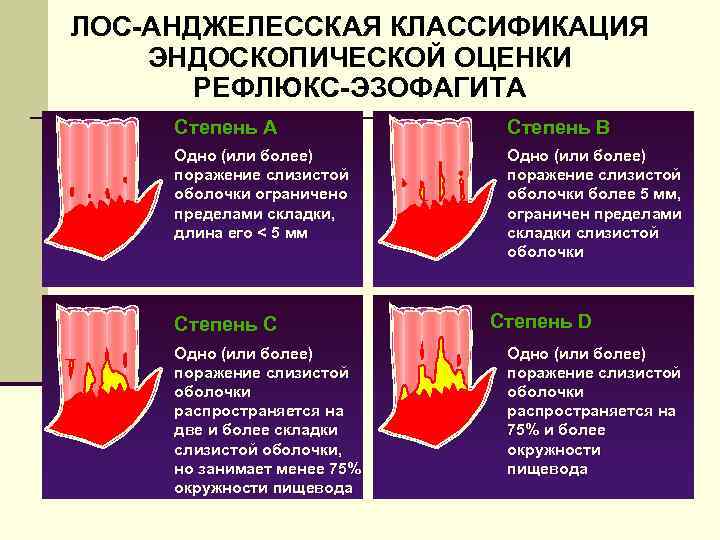 Классификация лос анджелес. Лос Анджелесская классификация эзофагитов. Лос-Анджелесская классификация рефлюкс-эзофагита (1994 г.). Лос Анджелесская классификация рефлюкса эзофагита. Рефлюкс эзофагит лосанжелеская.