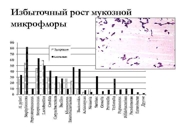 Избыточный рост мукозной микрофлоры 
