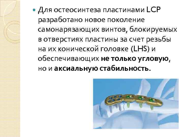  Для остеосинтеза пластинами LCP разработано новое поколение самонарязающих винтов, блокируемых в отверстиях пластины