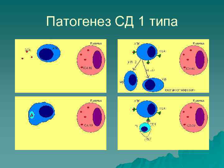 Патогенез СД 1 типа 