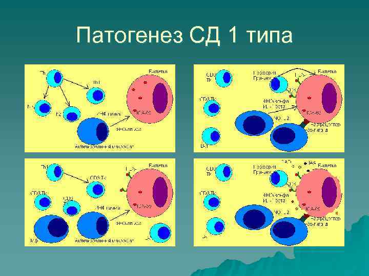 Патогенез СД 1 типа 