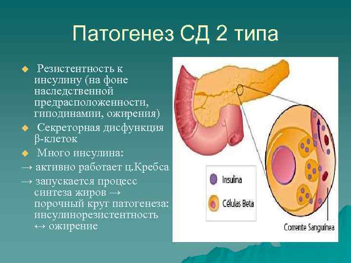 Патогенез СД 2 типа Резистентность к инсулину (на фоне наследственной предрасположенности, гиподинамии, ожирения) u
