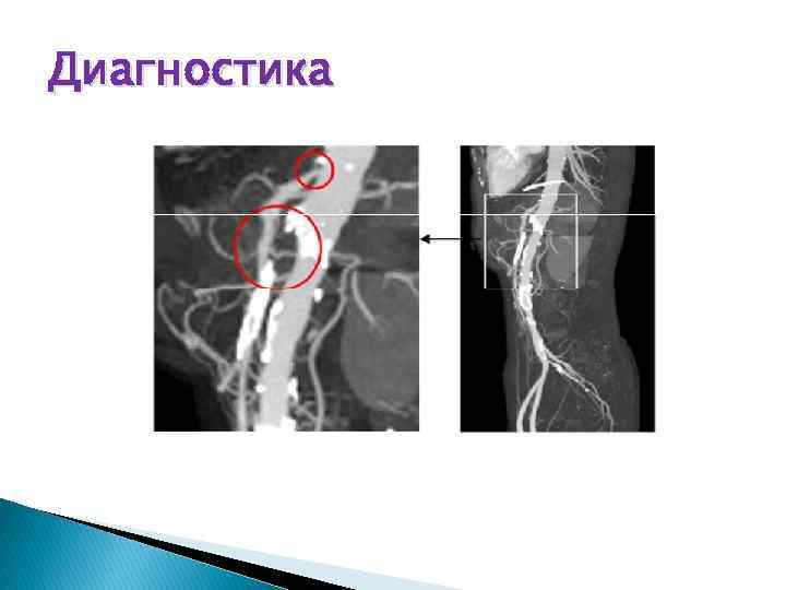 Диагностика 