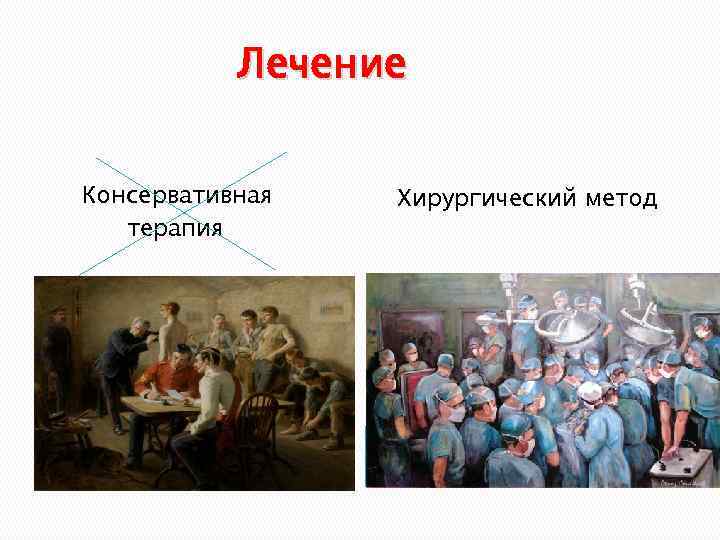 Лечение Консервативная терапия Хирургический метод 