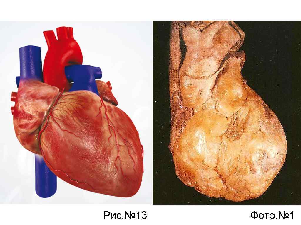 Рис. № 13 Фото. № 1 