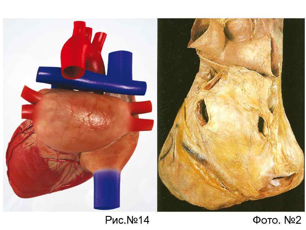 Рис. № 14 Фото. № 2 