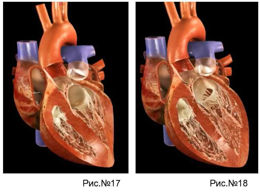 Рис. № 17 Рис. № 18 