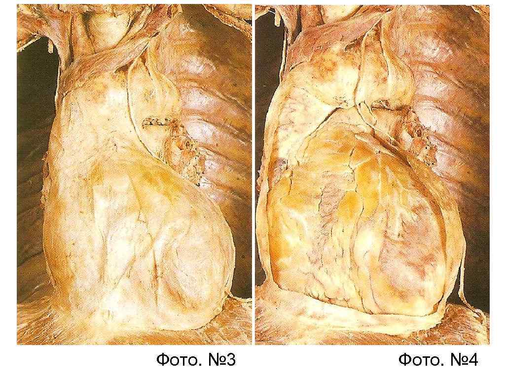 Фото. № 3 Фото. № 4 