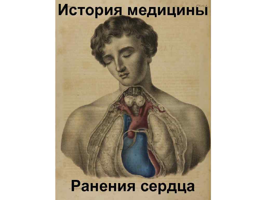 История медицины Ранения сердца 