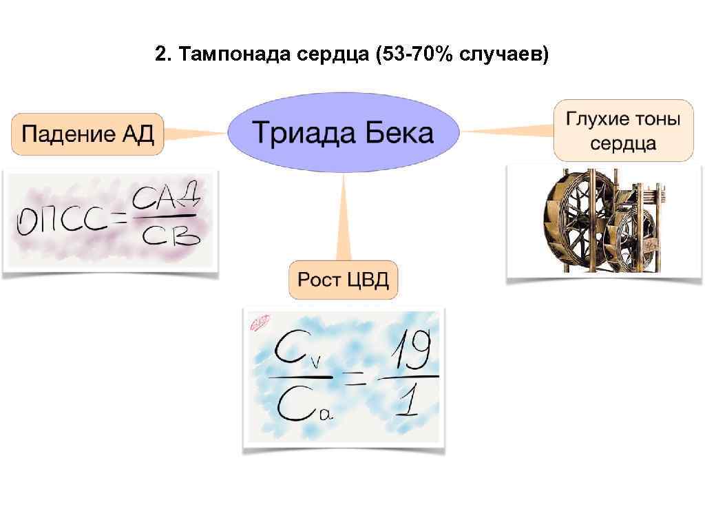 2. Тампонада сердца (53 -70% случаев) 