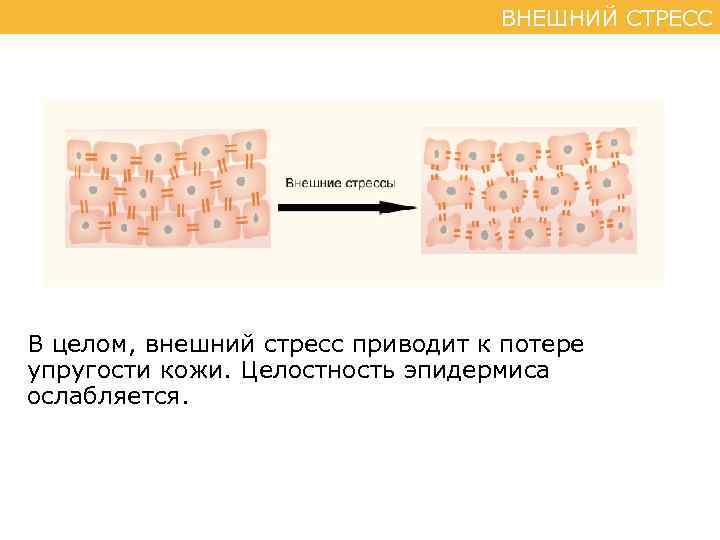 ВНЕШНИЙ СТРЕСС В целом, внешний стресс приводит к потере упругости кожи. Целостность эпидермиса ослабляется.
