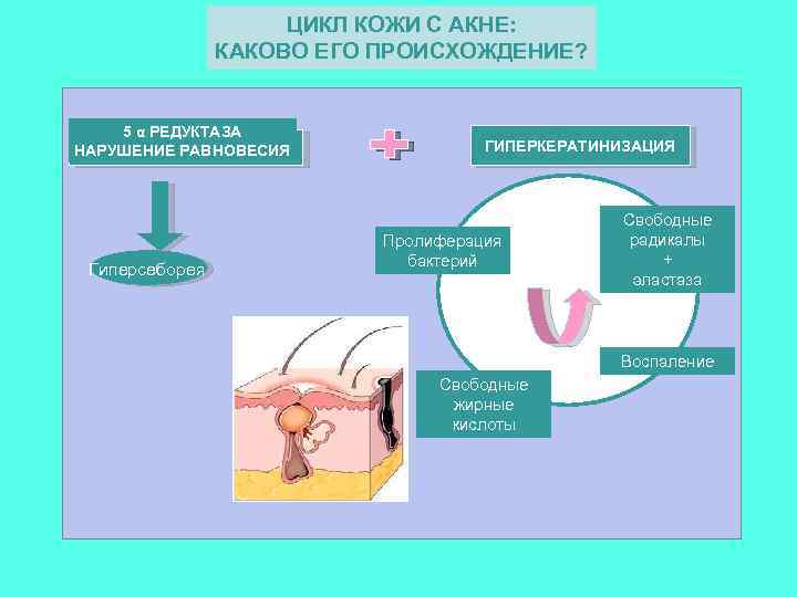 ЦИКЛ КОЖИ С АКНЕ: КАКОВО ЕГО ПРОИСХОЖДЕНИЕ? 5 α РЕДУКТАЗА НАРУШЕНИЕ РАВНОВЕСИЯ Гиперсеборея ГИПЕРКЕРАТИНИЗАЦИЯ