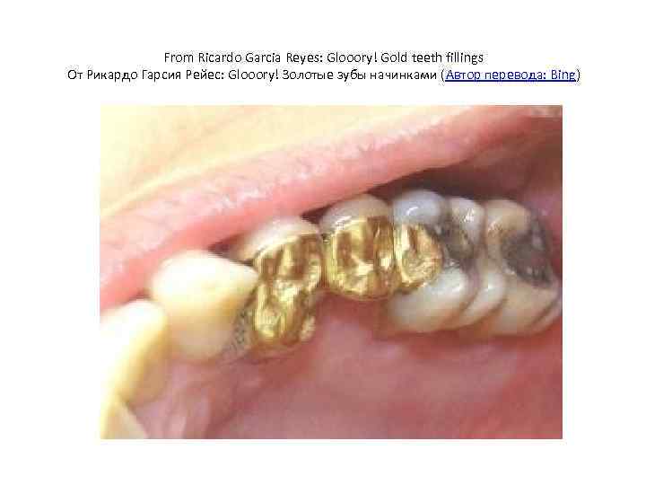 From Ricardo Garcia Reyes: Glooory! Gold teeth fillings От Рикардо Гарсия Рейес: Glooory! Золотые