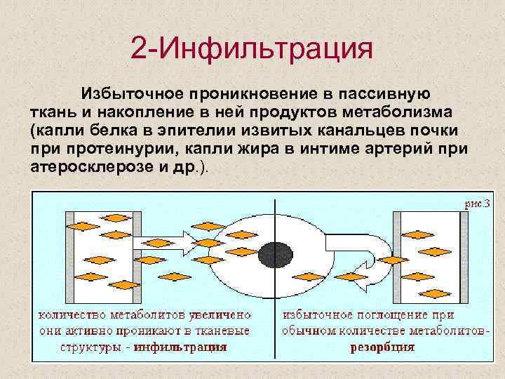 2 -Инфильтрация Избыточное проникновение в пассивную ткань и накопление в ней продуктов метаболизма (капли