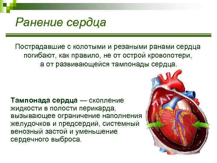 Ранение сердца Пострадавшие с колотыми и резаными ранами сердца погибают, как правило, не от