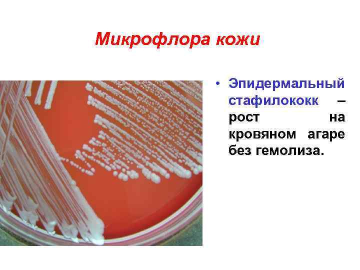 Микрофлора кожи • Эпидермальный стафилококк – рост на кровяном агаре без гемолиза. 