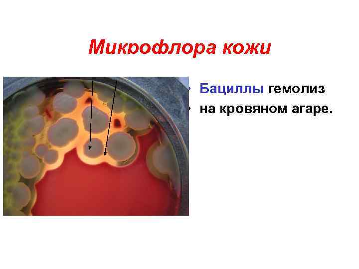 Микрофлора кожи • Бациллы гемолиз • на кровяном агаре. 