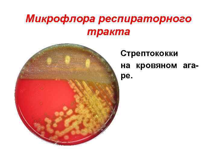 Микрофлора респираторного тракта • Стрептококки • на кровяном агаре. 