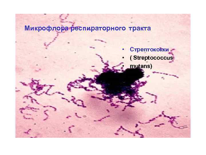 Микрофлора респираторного тракта • Стрептококки • ( Streptococcus • mutans) 