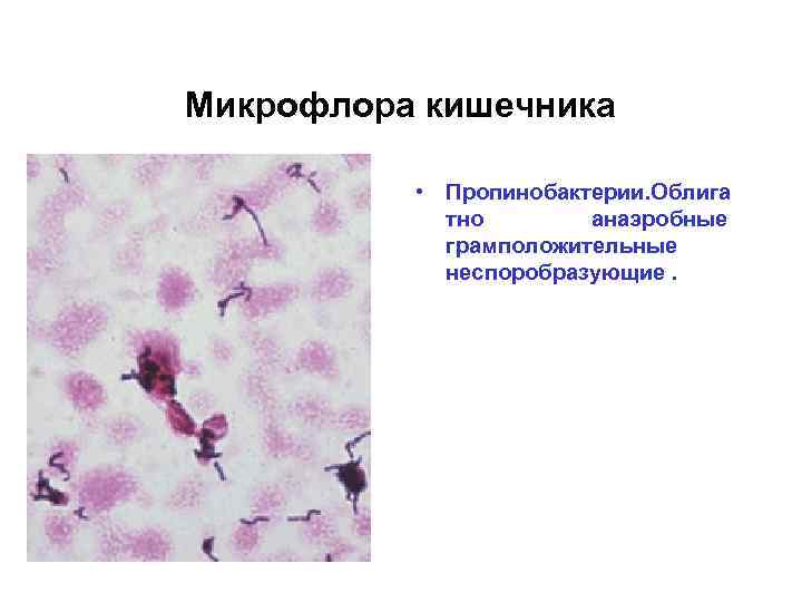 Микрофлора кишечника • Пропинобактерии. Облига тно анаэробные грамположительные неспоробразующие. 