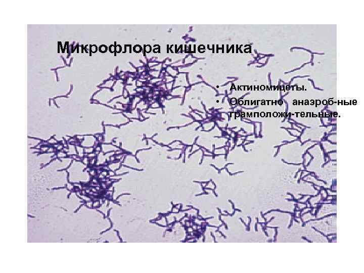 Микрофлора кишечника • Актиномицеты. • Облигатно анаэроб-ные грамположи-тельные. 