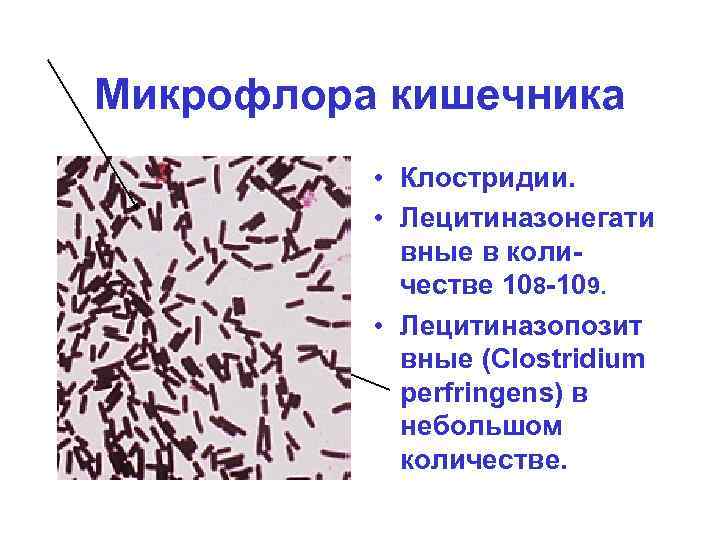 Микрофлора кишечника • Клостридии. • Лецитиназонегати вные в количестве 108 -109. • Лецитиназопозит вные