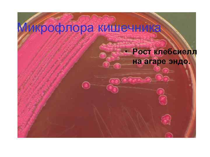 Микрофлора кишечника • Рост клебсиелл на агаре эндо. 