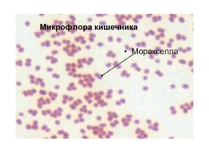 Микрофлора кишечника • Моракселла 