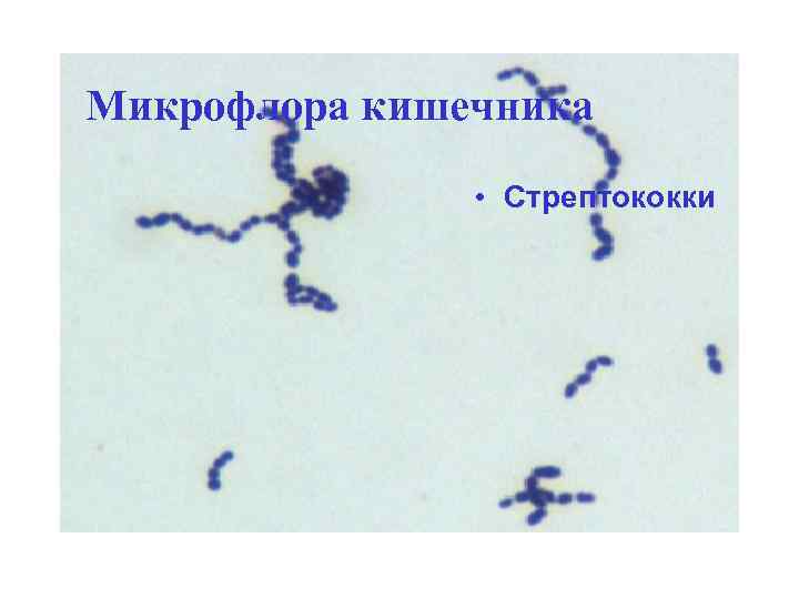 Микрофлора кишечника • Стрептококки 