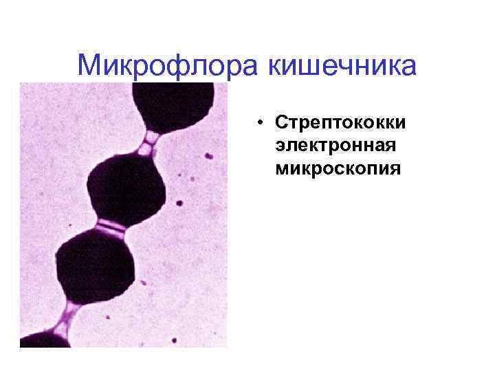 Микрофлора кишечника • Стрептококки электронная микроскопия 