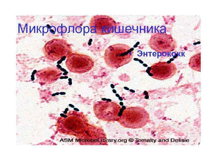 Микрофлора кишечника • Энтерококк 