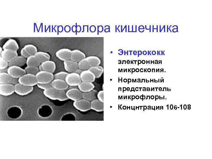 Микрофлора кишечника • Энтерококк электронная микроскопия. • Нормальный представитель микрофлоры. • Концнтрация 106 -108