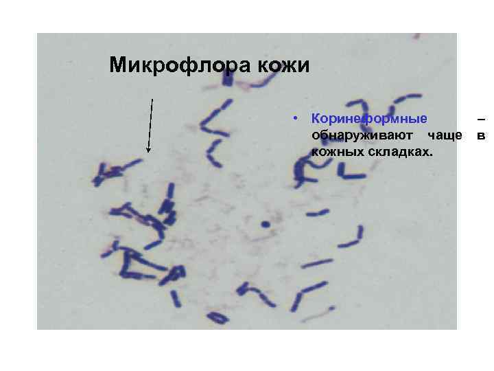 Микрофлора кожи • Коринеформные обнаруживают чаще кожных складках. – в 