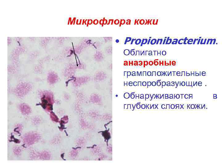 Микрофлора кожи • Propionibacterium. Облигатно анаэробные грамположительные неспоробразующие. • Обнаруживаются в глубоких слоях кожи.