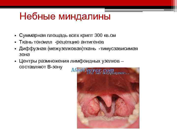 Небные миндалины • Суммарная площадь всех крипт 300 кв. см • Ткань тонзилл -рецепцию