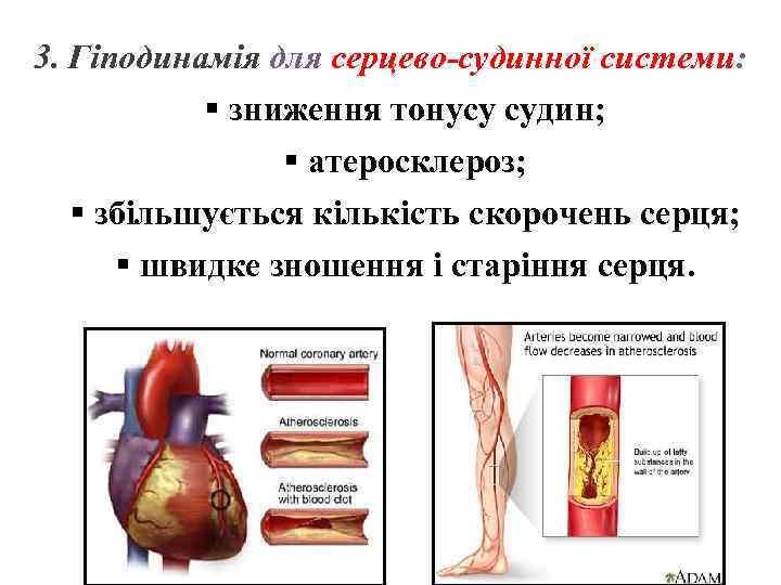 3. Гіподинамія для серцево-судинної системи: § зниження тонусу судин; § атеросклероз; § збільшується кількість