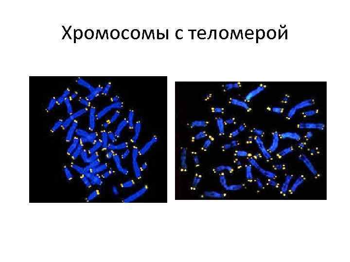 Хромосомы с теломерой 