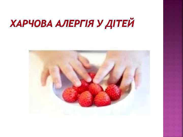 ХАРЧОВА АЛЕРГІЯ У ДІТЕЙ 