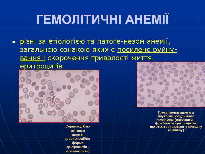 ГЕМОЛІТИЧНІ АНЕМІЇ n різні за етіолоґією та патоґе-незом анемії, етіоло пато загальною ознакою яких