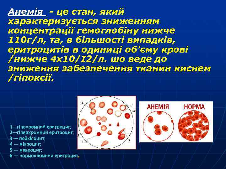 Анемія - це стан, який характеризується зниженням концентрації гемоглобіну нижче 110 г/л, та, в