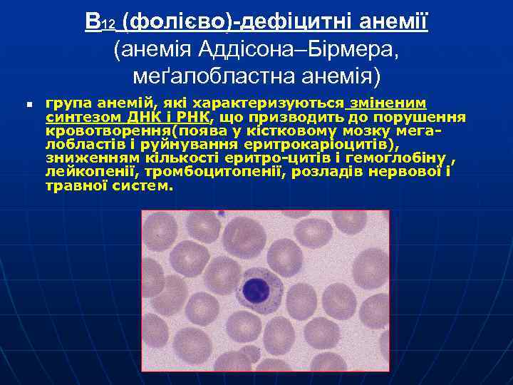 В 12 (фолієво)-дефіцитні анемії (анемія Аддісона–Бірмера, меґалобластна анемія) ме n група анемій, які характеризуються