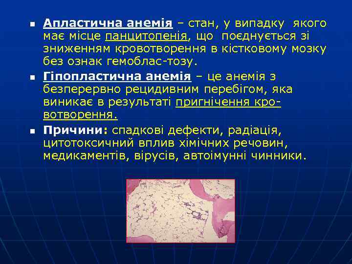 n n n Апластична анемія – стан, у випадку якого має місце панцитопенія, що