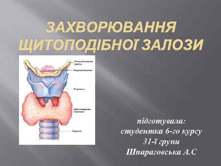 ЗАХВОРЮВАННЯ ЩИТОПОДІБНОЇ ЗАЛОЗИ підготувала: студентка 6 -го курсу 31 -ї групи Шпараговська А. С